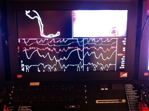 Telemetry data from a racing car. The contour of the racing track is shown in the upper left corner and various data channels are displayed below.